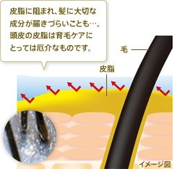 毛穴の皮脂に跳ね返される成分　毛穴のまわりに自然と頭皮の脂がたまり毛穴をふさいでしまって、髪に大切な成分が届きづらいことも・・・。頭皮の脂は頭皮ケアにとっては厄介なものです。