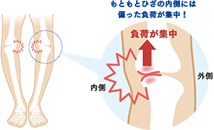 もともとひざの内側には偏った負荷が集中!