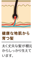 健康な地肌から育つ髪　太く丈夫な髪が根元からしっかり生えています。
