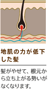 地肌の力が低下した髪　髪がやせて、根元から立ち上がる勢いがなくなります。