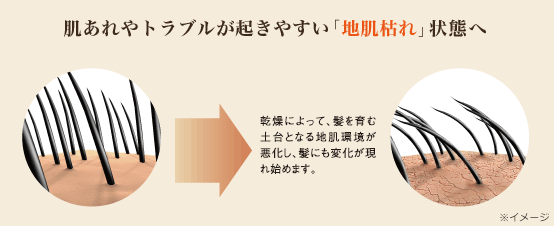 肌あれやトラブルが起きやすい「地肌枯れ」状態へ　乾燥によって、髪を育む土台となる地肌環境が悪化し、髪にも変化が現れ始めます。　※イメージ