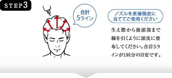 STEP3　ノズルを直接頭皮に当ててご使用ください 生え際から後頭部まで線を引くように頭皮に塗布してください。合計５ラインが1回分の目安です。