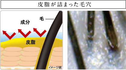 皮脂が詰まった毛穴 成分 毛 皮脂 イメージ図