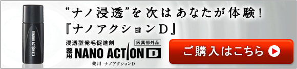 “ナノ浸透”を次はあなたが体験！『ナノアクションD』浸透型発毛促進剤　薬用NANOACTIOND　薬用 ナノアクションD　医薬部外品　ご購入はこちら