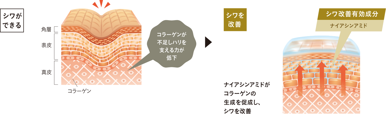 シワができる原因改善