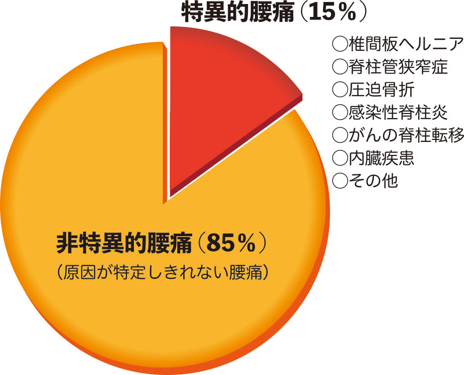 なぜ腰痛になるの その原因とは サントリーグッドエイジングラボ